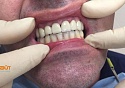 Лечение протезирование зубов в уфе thumbnail