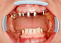 Лечение зуба сколько стоит в уфе