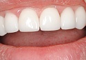 Лечение зуба сколько стоит в уфе